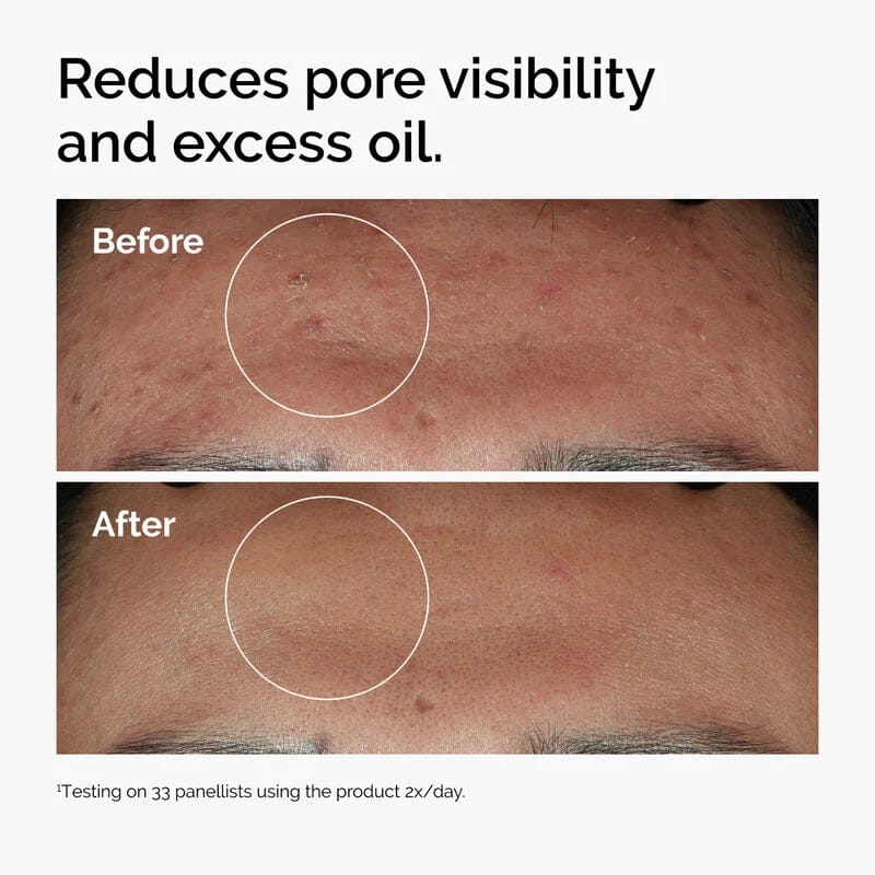 The Ordinary Niacinamide 10%+Zinc 1% Serum